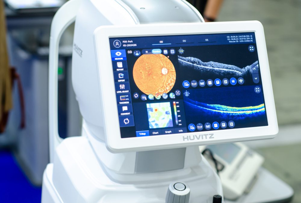 angio_oct_maculopatie_diagnosi