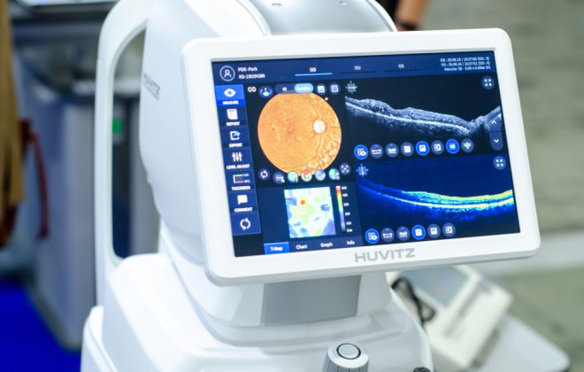 angio_oct_maculopatie_diagnosi