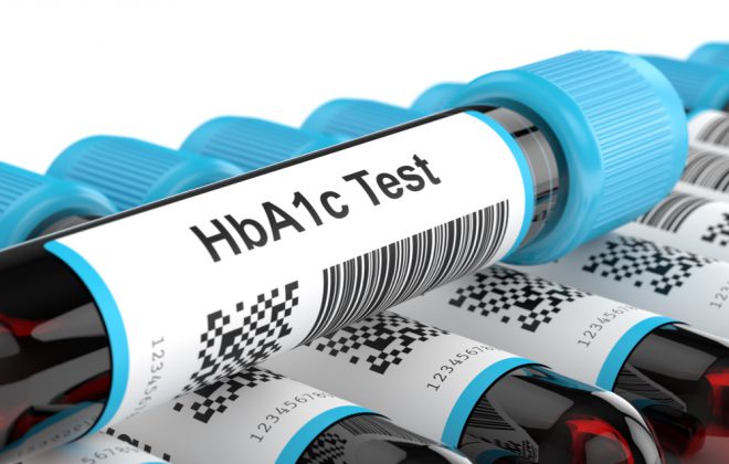 emoglobina_glicata_valori_diabete