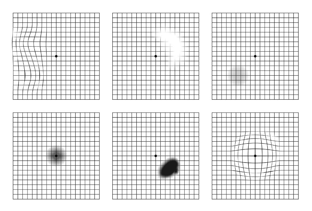 test_griglia_amsler_maculopatia