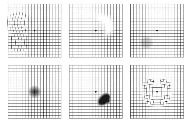 test_griglia_amsler_maculopatia