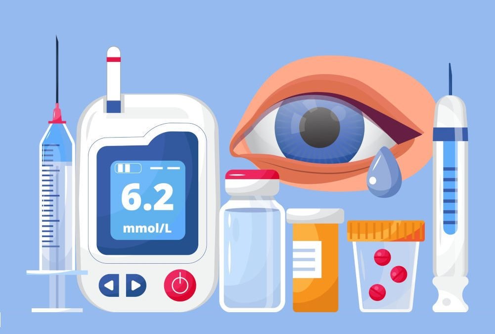 Vista e diabete: i falsi miti